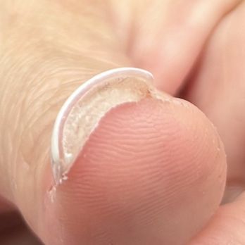 A-List Nails Spa - So much glue she said was normal - Nail Salons Near Me - Fullerton, California