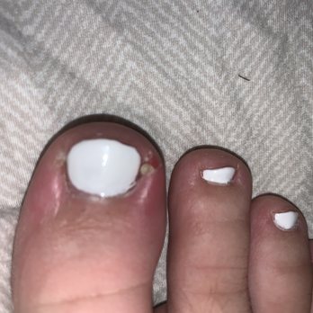 Bonvie Nails & Spa - Infection - Nail Salons Near Me - Forest Grove, Oregon Bonvie Nails & Spa - Infection - Nail Salons Near Me - Forest Grove, Oregon