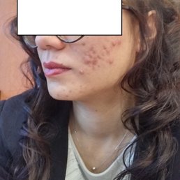 Bernard Peyronnet - Quand je voyais Dr Peyronnet - Dermatologists Near Me - Paris, 75