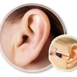 Starwood Audiology