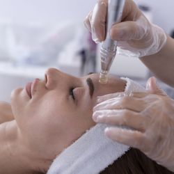 R3 Anti-Aging & Medspa - Scottsdale - Microneedling.