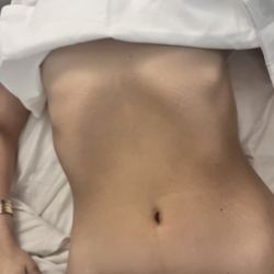 LymphGlo - After body contouring
