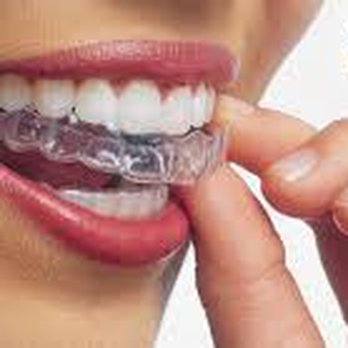 Michael J Harmon, DDS - Harmon Dental - Invisalign Provider. - Cosmetic Dentists Near Me - Centennial, Colorado Michael J Harmon, DDS - Harmon Dental - Invisalign Provider. - Cosmetic Dentists Near Me - Centennial, Colorado