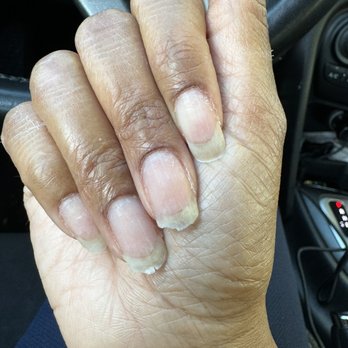 Noire Nail Bar - After the removal - Nail Salons Near Me - Atlanta, Georgia Noire Nail Bar - After the removal - Nail Salons Near Me - Atlanta, Georgia