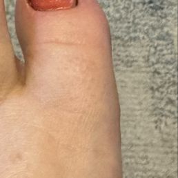 She was trying to assist with ingrown toenails.  Both big toes are a mess and I'm trying hard to keep them from it getting infected.