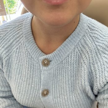 Mosaic Skin Studio - My lips before lip fillers - Skin Care Near Me - Oakland, California