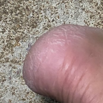 Luxury Nail Bar - Cracked and peeling skin on my heel AFTER the pedicure - Nail Salons Near Me - Nashville, Tennessee