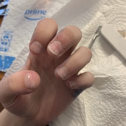 Nail Designs - Ruined nails