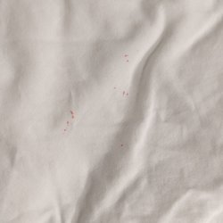 Bayside Inn & Waterfront Suites - Bedbug splotches