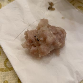 Oriental Chef - A piece of hair found in the Steamed Pork with Salted Fish - Seafood Near Me - Stockton, California