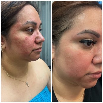 Haus of Recovery  - Skin Care Near Me - San Dimas, California