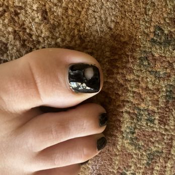 Lavender Nailspa - Peeled gel after one day - Nail Salons Near Me - Sacramento, California Lavender Nailspa - Peeled gel after one day - Nail Salons Near Me - Sacramento, California