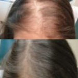 Dhirendra Kumar - MD Medspa BelRed