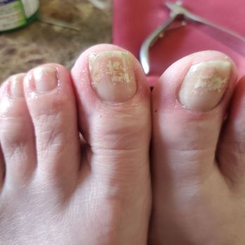 Cutie Nails & Spa - My toenails with fungus - Nail Salons Near Me - Lomita, California Cutie Nails & Spa - My toenails with fungus - Nail Salons Near Me - Lomita, California
