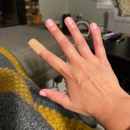 The hand with the injured finger