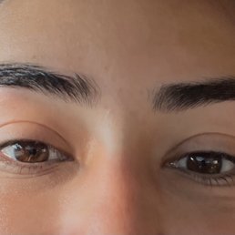 After the swelling went down! I love my brows now thanks to the brow experts