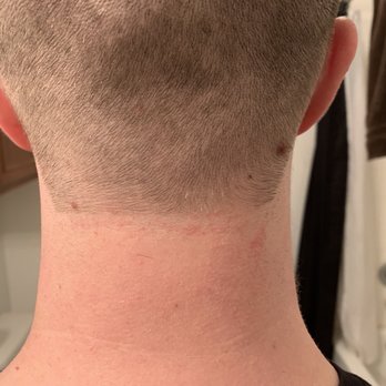 Boardroom Salon for Men - One day after my haircut. Razor burn still hurts pretty bad. Uneven in the back. Sloppy - Men's Hair Salons Near Me - Kingwood, Texas Boardroom Salon for Men - One day after my haircut. Razor burn still hurts pretty bad. Uneven in the back. Sloppy - Men's Hair Salons Near Me - Kingwood, Texas