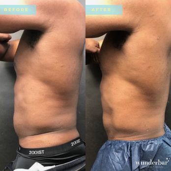 Korman Plastic Surgery - Cosmetic Surgeons Near Me - Carmel, California Korman Plastic Surgery - Cosmetic Surgeons Near Me - Carmel, California