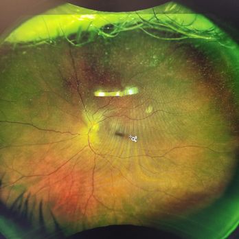 Berkeley Eye Center - Memorial - Optometrists Near Me - Houston, Texas