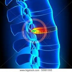 Simply Chiropractic & Laser
