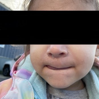 Basic Beginnings - Mucus running down nose and stuck to face. Eyes blocked for privacy but her eyebrows too had mucus gooped to them. - Child Care & Day Care Near Me - Haverhill, Massachusetts Basic Beginnings - Mucus running down nose and stuck to face. Eyes blocked for privacy but her eyebrows too had mucus gooped to them. - Child Care & Day Care Near Me - Haverhill, Massachusetts