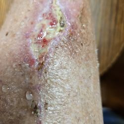 Daniel Hoffman - Skin Win Dermatology