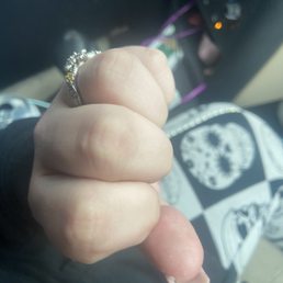 My nail that is connected to my thumb My nail that is connected to my thumb