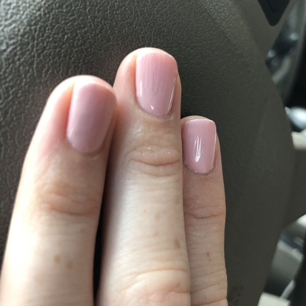 Bumpy and uneven nails