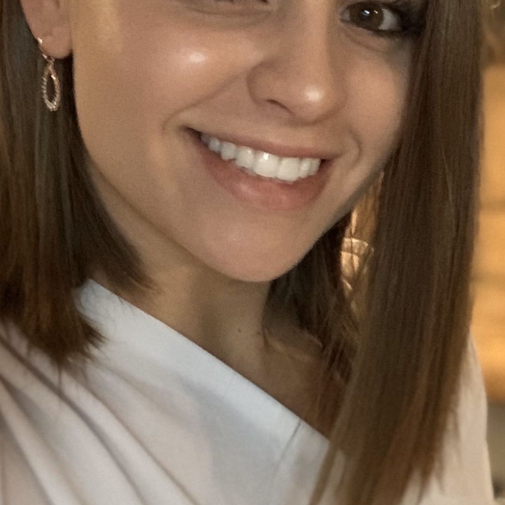 Beth L Snyder, DMD - After my veneer was placed over my front tooth, which used to be yellow but now beautifully matches the rest of my smile. - General Dentistry Near Me - Doylestown, Pennsylvania