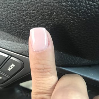Organic Nails - Bleeding on side of finger - Nail Technicians Near Me - Atlantic Beach, Florida Organic Nails - Bleeding on side of finger - Nail Technicians Near Me - Atlantic Beach, Florida
