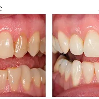 Violet Akhondzadeh, D.D.S., FICO - Cosmetic Dentists Near Me - Whittier, California Violet Akhondzadeh, D.D.S., FICO - Cosmetic Dentists Near Me - Whittier, California