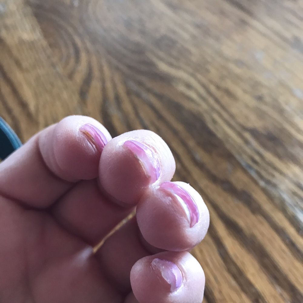 My nails when she did them (does that look like active length) how bad they look now My nails when she did them (does that look like active length) how bad they look now