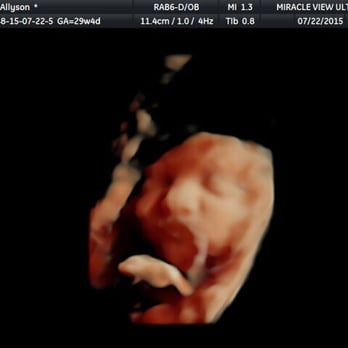 Miracle View 3D/4D Ultrasound - Obstetricians & Gynecologists Near Me - Phoenix, Arizona