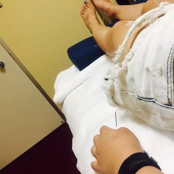 A Plus Acupuncture - Painless but helpful acupuncture treatment - Massage Near Me - San Jose, California