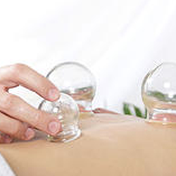 Brooklyn Acupuncture Project - Cupping at BAP. Helps to "unstick" muscles that may be causing other pain/and or structural imbalances.