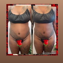 Design By His Imagination - One session of Cavitation 360 with RS