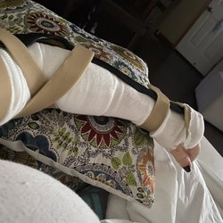 Hand and Microsurgery Associates - Temporary removable cast after the bandages were removed.