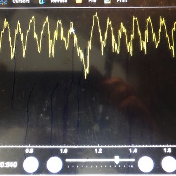 Lopez Automotive - Checking a compression with scope. - Auto Repair Near Me - Ukiah, California
