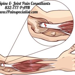 Houston Spine & Joint Pain Consultants - Are stem cell injections really helpful in TENNIS ELBOW ? YES THEY ARE. Call and book today !