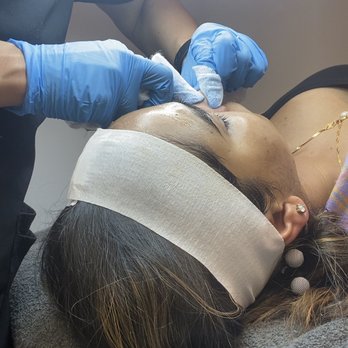 Vida Spa - Extraction is a part of a deep cleansing on our European facial and on our Lux Acne Facial - Medical Spas Near Me - New York, New York