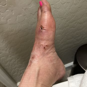 Zachary Flynn, DPM, FACFAS - Surgeons Near Me - Phoenix, Arizona Zachary Flynn, DPM, FACFAS - Surgeons Near Me - Phoenix, Arizona