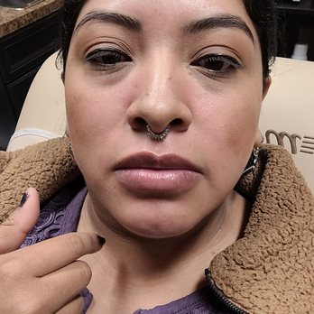 Euro Image Med Spa - My lips before filler - Medical Spas Near Me - Arlington, Texas Euro Image Med Spa - My lips before filler - Medical Spas Near Me - Arlington, Texas