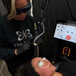 The Jab Lab: Aesthetics and Wellness - Alma Hybrid CO2 Laser Skin Resurfacing