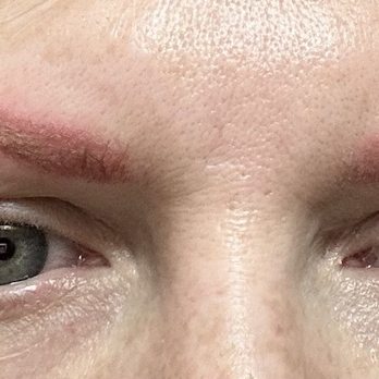 Daela Cosmetic Tattoo - Reaction to a service done on eyebrows - Tattoo Near Me - Portland, Oregon