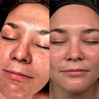 Aeri Aesthetics - Skin Care Near Me - Conroe, Texas Aeri Aesthetics - Skin Care Near Me - Conroe, Texas