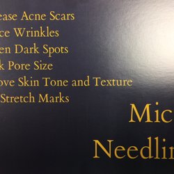 Comprehensive Dermatology of Rochester - Microneedling is here!