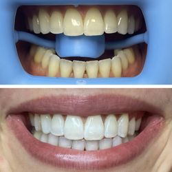 Glow Dental Hygiene