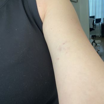Restore Hyper Wellness - IV Hydration Near Me - Redondo Beach, California
