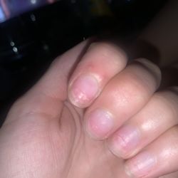 River Nail Spa - Pay attention to the clear line indentation, this is two months later like wtf