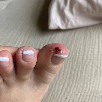 Ruby Nails - My toe hurts - Nail Salons Near Me - Draper, Utah